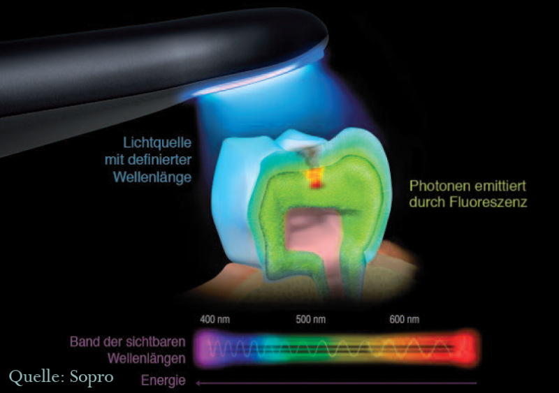 Laserfluoreszenz